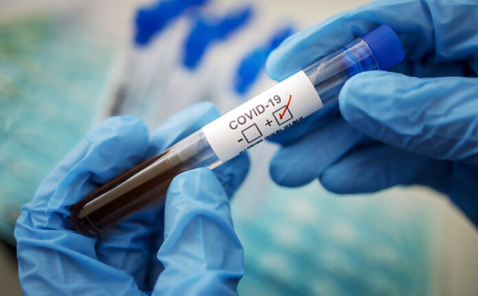 Gestellte Aufnahme. Symbolfoto: Coronavirus Diagnose. COVID-19, SARS-CoV-2. Berlin 17.03.2020 Berlin Deutschland *** Pr